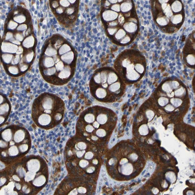 ARHGEF16 Antibody in Immunohistochemistry (Paraffin) (IHC (P))