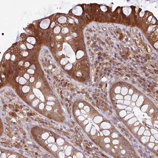 NT5C3A Antibody in Immunohistochemistry (IHC)