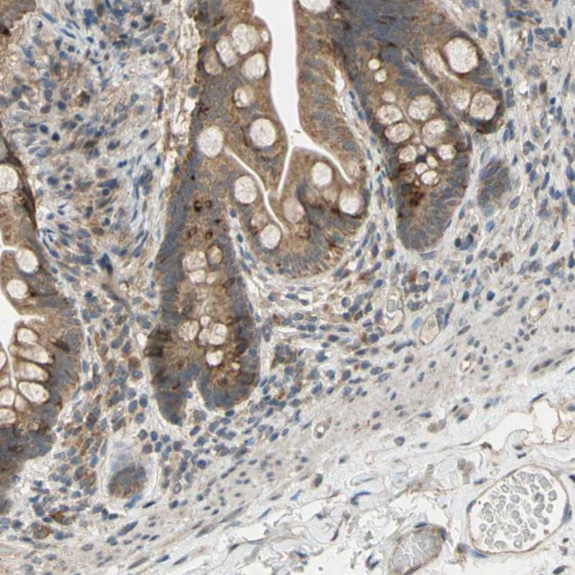 CD164 Antibody in Immunohistochemistry (Paraffin) (IHC (P))