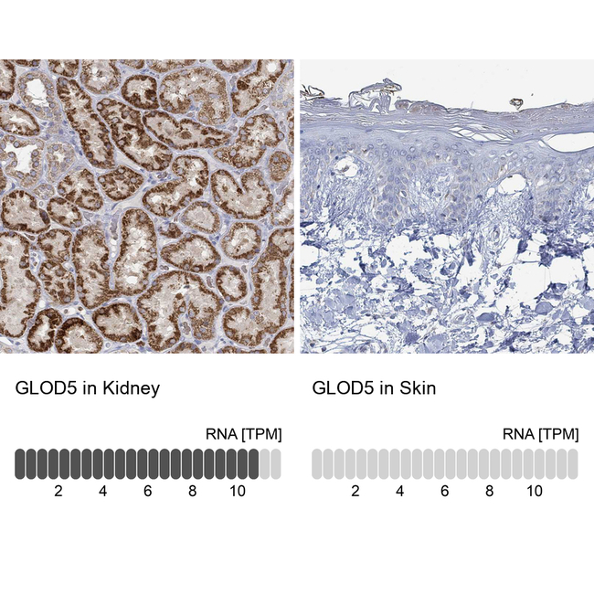 GLOD5 Antibody in Immunohistochemistry (Paraffin) (IHC (P))
