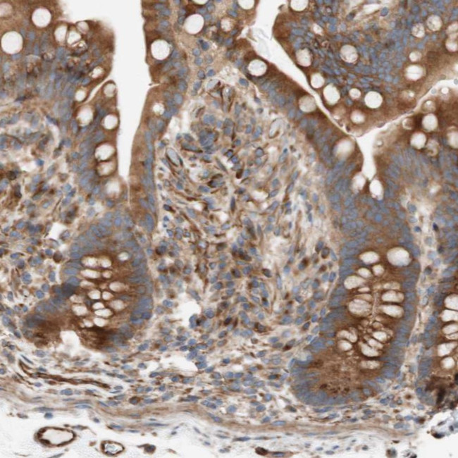C1orf43 Antibody in Immunohistochemistry (Paraffin) (IHC (P))