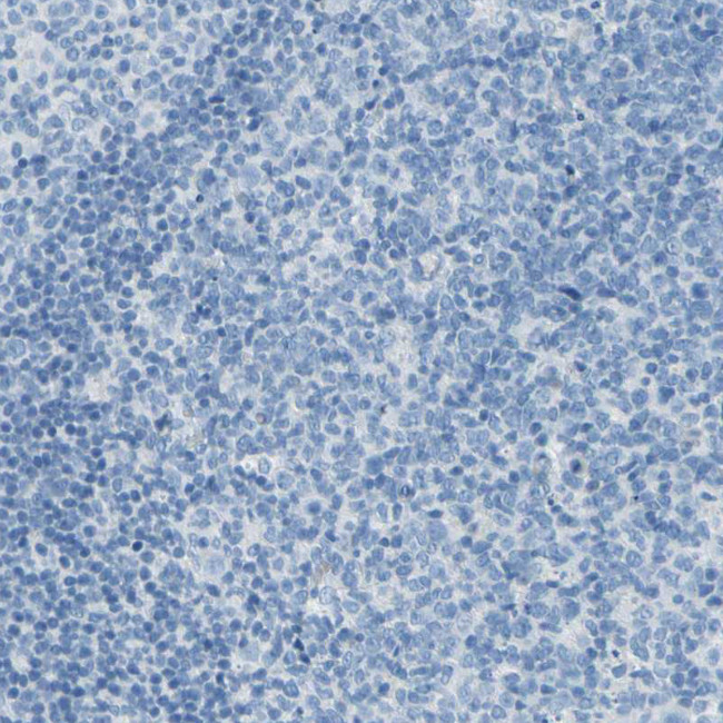 DCT Antibody in Immunohistochemistry (Paraffin) (IHC (P))