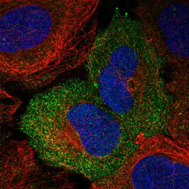 Nectin 4 Antibody in Immunocytochemistry (ICC/IF)
