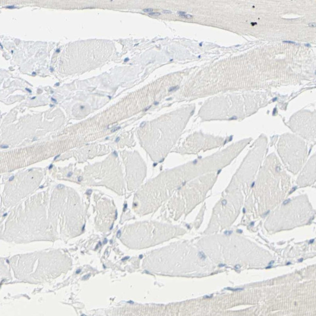 DCT Antibody in Immunohistochemistry (Paraffin) (IHC (P))