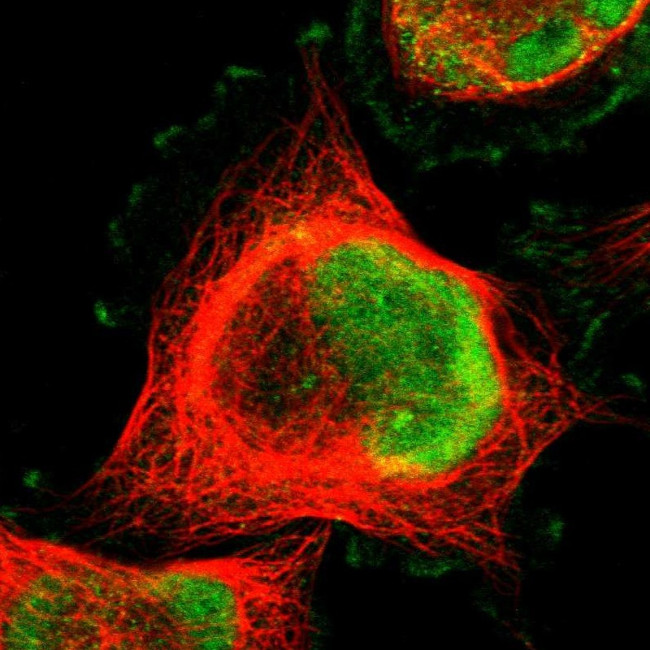 MLF2 Antibody in Immunocytochemistry (ICC/IF)