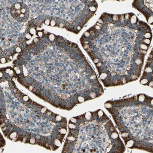 OSTM1 Antibody in Immunohistochemistry (Paraffin) (IHC (P))