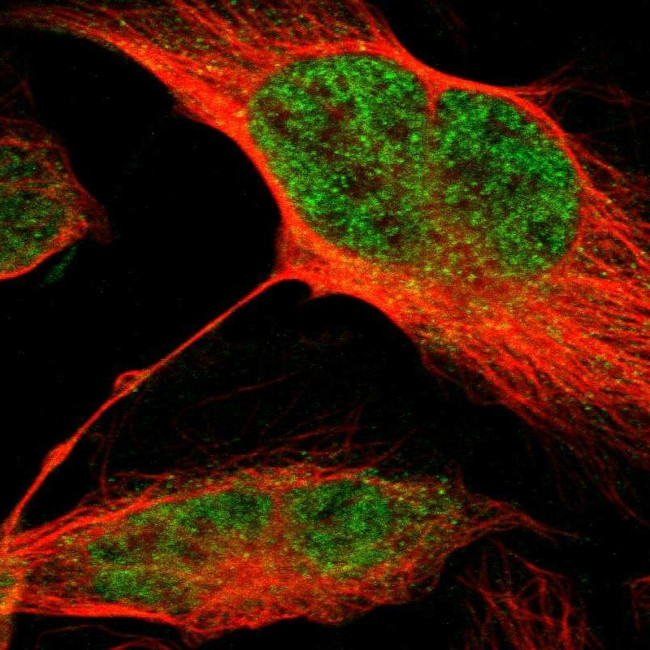 MLF2 Antibody in Immunocytochemistry (ICC/IF)