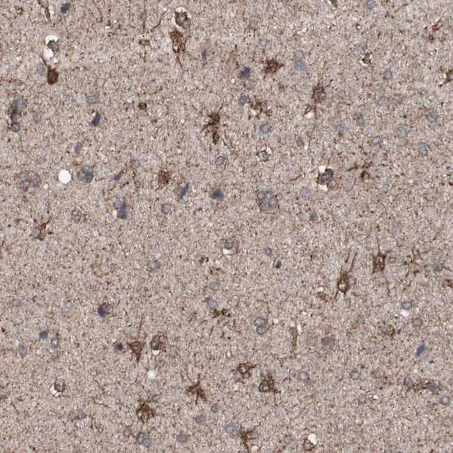 ALDH9A1 Antibody in Immunohistochemistry (Paraffin) (IHC (P))