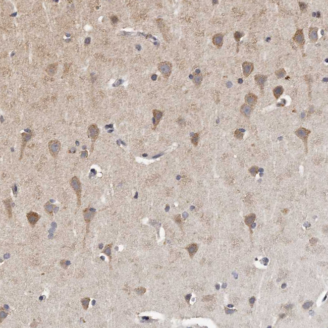 MGAT5 Antibody in Immunohistochemistry (Paraffin) (IHC (P))