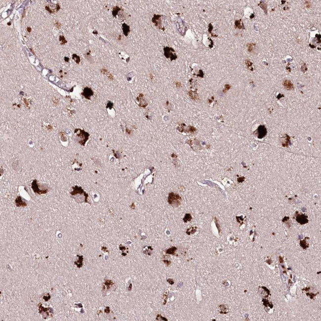 C9orf89 Antibody in Immunohistochemistry (Paraffin) (IHC (P))