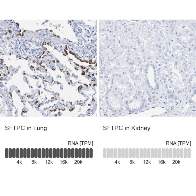 SFTPC Antibody in Immunohistochemistry (IHC)