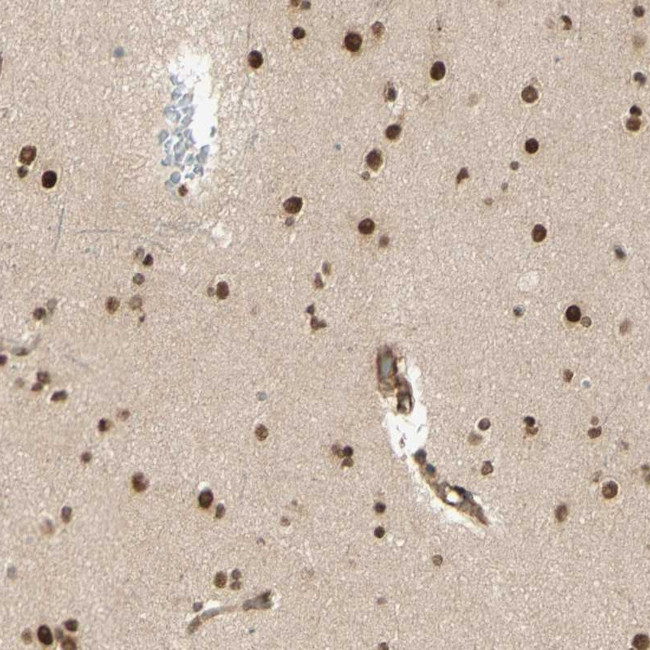 ZNF258 Antibody in Immunohistochemistry (Paraffin) (IHC (P))