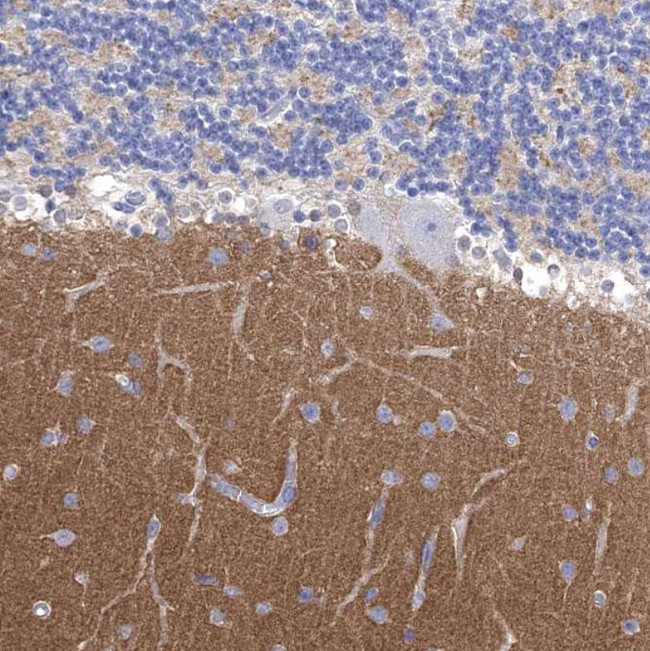 SYT12 Antibody in Immunohistochemistry (Paraffin) (IHC (P))