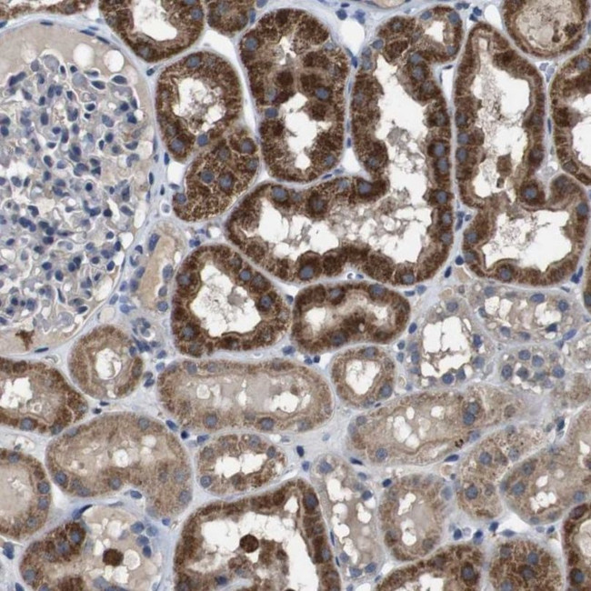 GLIPR1 Antibody in Immunohistochemistry (IHC)