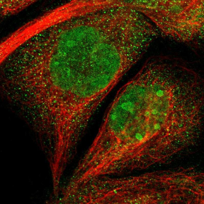 TMEM24 Antibody in Immunocytochemistry (ICC/IF)