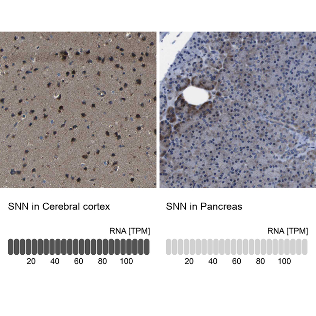 SNN Antibody in Immunohistochemistry (Paraffin) (IHC (P))