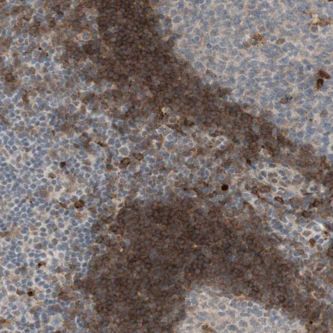 GAPT Antibody in Immunohistochemistry (Paraffin) (IHC (P))
