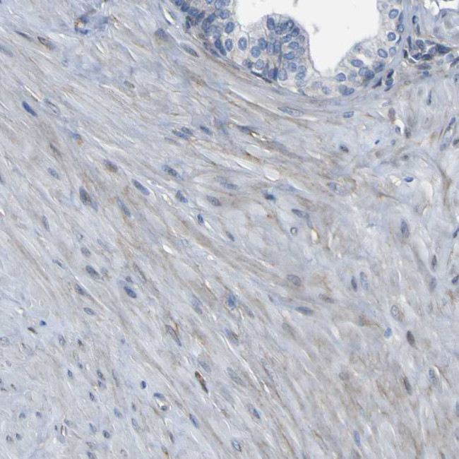 LRRN1 Antibody in Immunohistochemistry (Paraffin) (IHC (P))