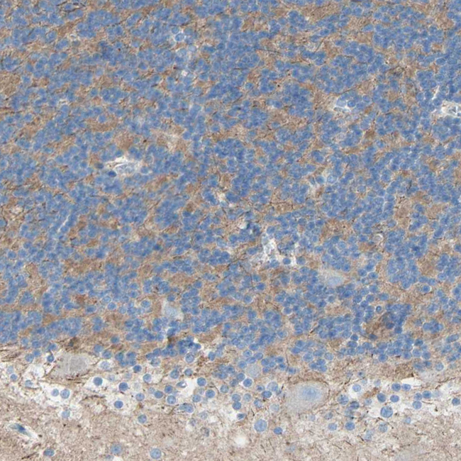 TMIGD2 Antibody in Immunohistochemistry (Paraffin) (IHC (P))