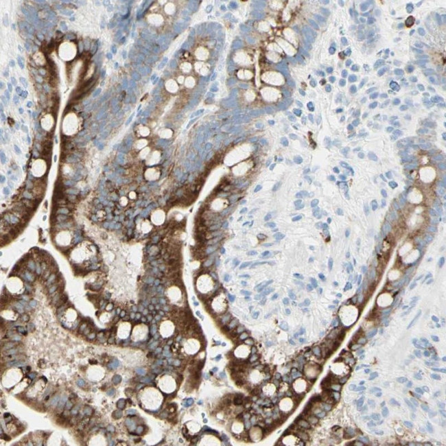 LETM1 Antibody in Immunohistochemistry (Paraffin) (IHC (P))