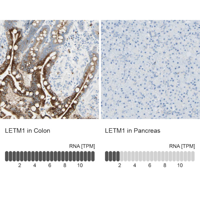LETM1 Antibody in Immunohistochemistry (IHC)