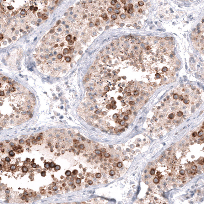 HAI-2 Antibody in Immunohistochemistry (Paraffin) (IHC (P))