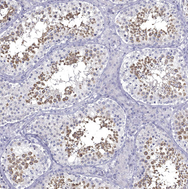 GALNTL5 Antibody in Immunohistochemistry (Paraffin) (IHC (P))