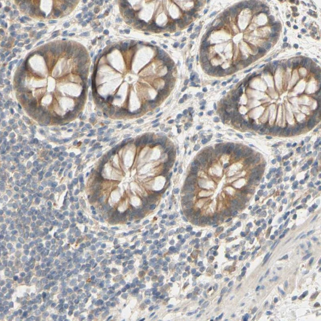 SMIM19 Antibody in Immunohistochemistry (Paraffin) (IHC (P))