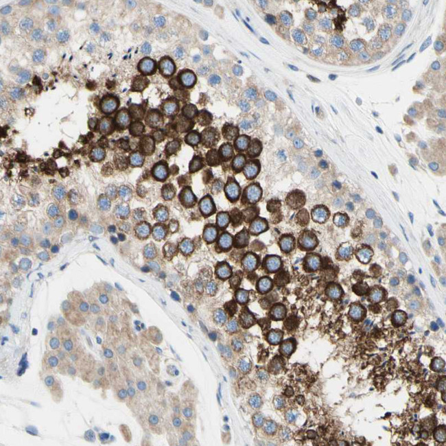 FAM134A Antibody in Immunohistochemistry (Paraffin) (IHC (P))