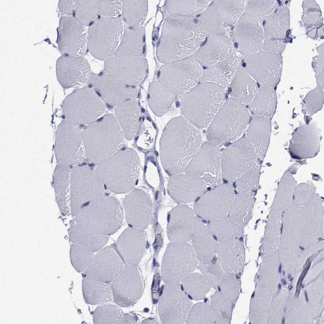 CDHR3 Antibody in Immunohistochemistry (Paraffin) (IHC (P))