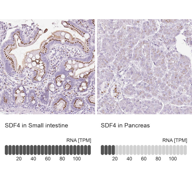 SDF4 Antibody in Immunohistochemistry (IHC)