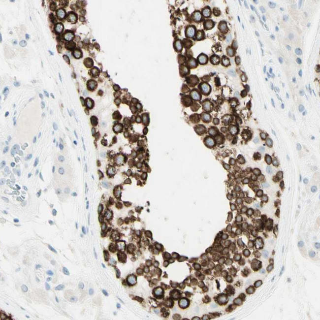 FMR1NB Antibody in Immunohistochemistry (Paraffin) (IHC (P))