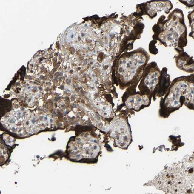 C1GALT1 Antibody in Immunohistochemistry (Paraffin) (IHC (P))
