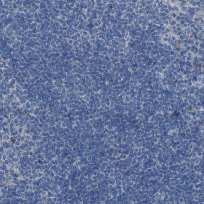 SGK2 Antibody in Immunohistochemistry (Paraffin) (IHC (P))