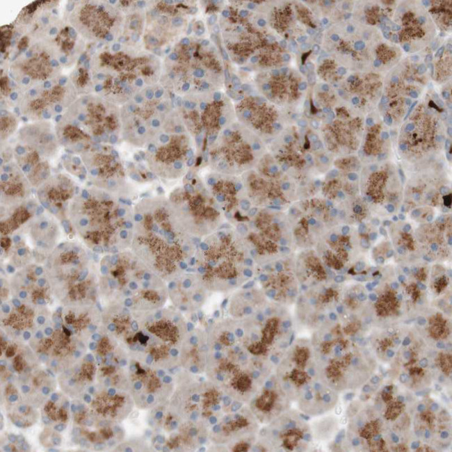 PEX2 Antibody in Immunohistochemistry (Paraffin) (IHC (P))