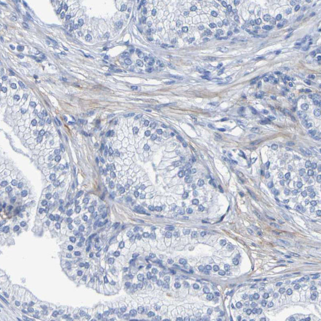 SGCB Antibody in Immunohistochemistry (Paraffin) (IHC (P))