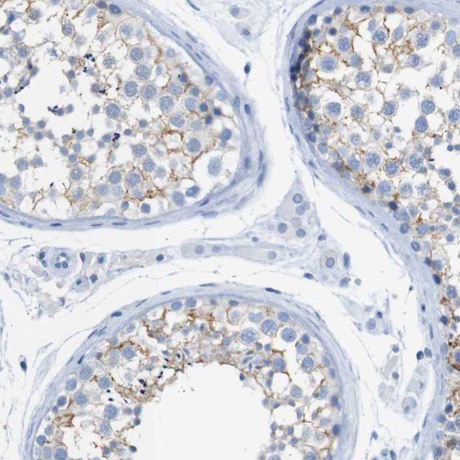 ERVMER34-1 Antibody in Immunohistochemistry (Paraffin) (IHC (P))
