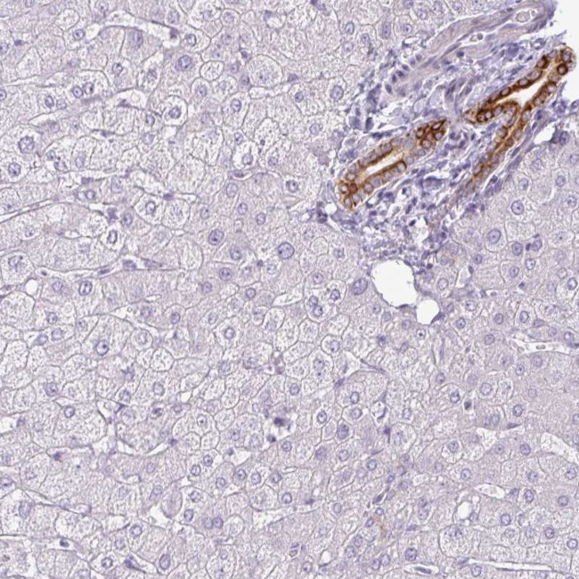 SIRPB2 Antibody in Immunohistochemistry (Paraffin) (IHC (P))
