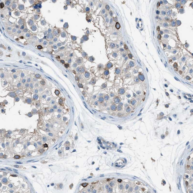 HEG1 Antibody in Immunohistochemistry (Paraffin) (IHC (P))
