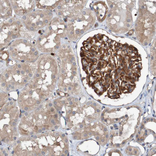 ST8SIA6 Antibody in Immunohistochemistry (Paraffin) (IHC (P))