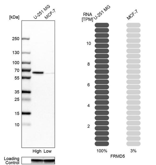 FRMD5 Antibody in Western Blot (WB)
