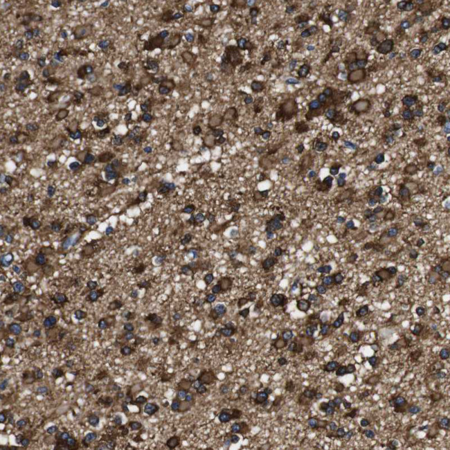 LRIG1 Antibody in Immunohistochemistry (IHC)