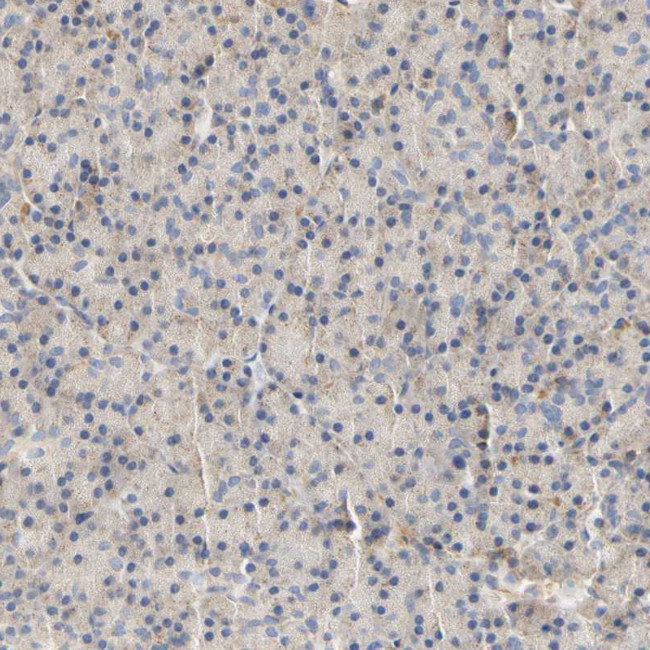 PCDH7 Antibody in Immunohistochemistry (IHC)