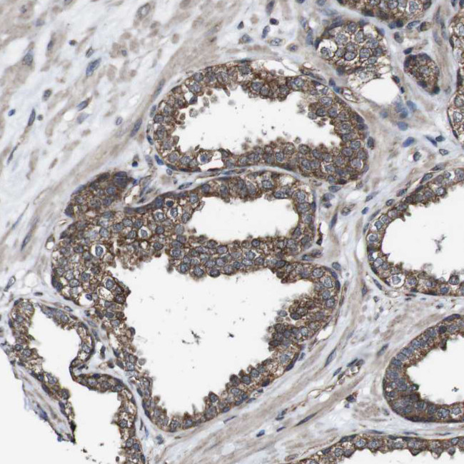 BTN3A3 Antibody in Immunohistochemistry (Paraffin) (IHC (P))