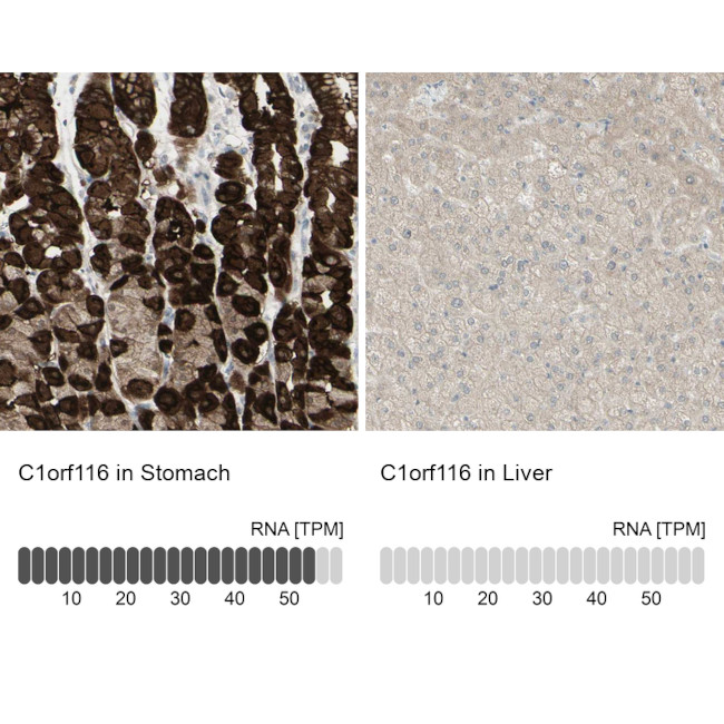 SARG Antibody in Immunohistochemistry (IHC)