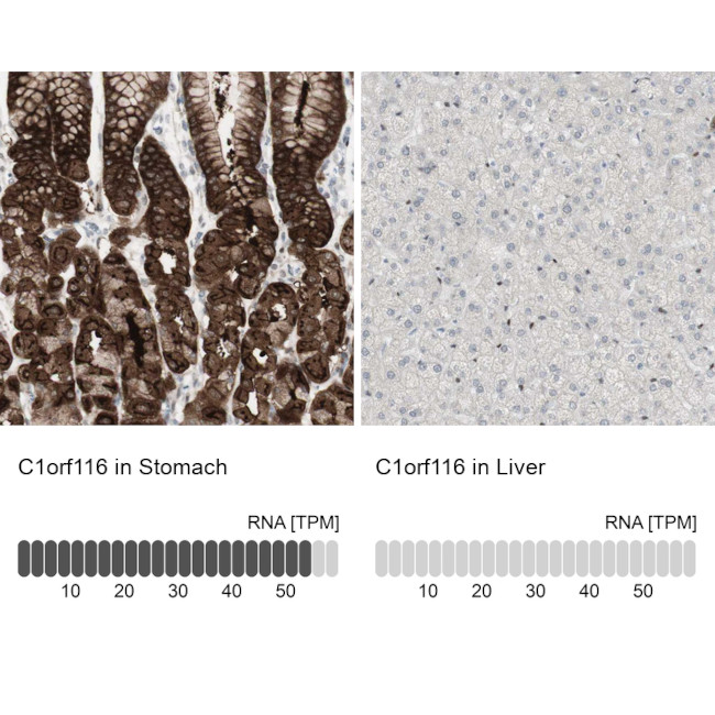 SARG Antibody in Immunohistochemistry (IHC)