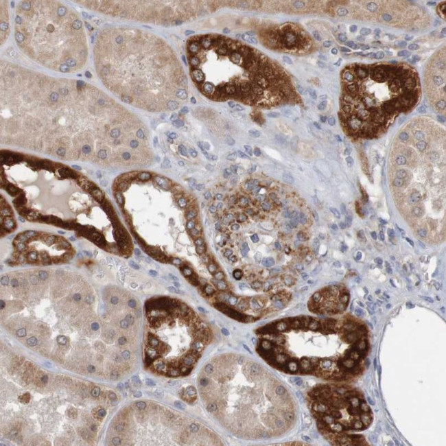NAV2 Antibody in Immunohistochemistry (Paraffin) (IHC (P))