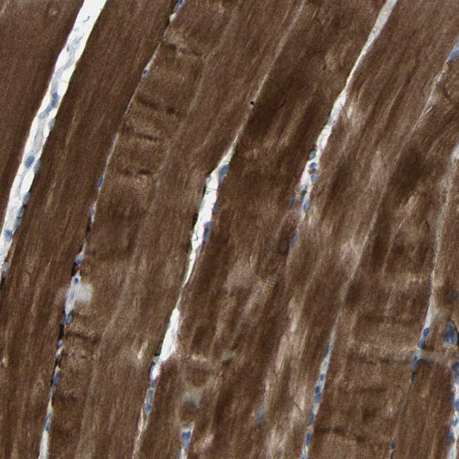 STBD1 Antibody in Immunohistochemistry (Paraffin) (IHC (P))