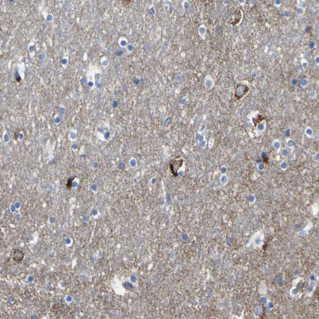 HK1 Antibody in Immunohistochemistry (Paraffin) (IHC (P))