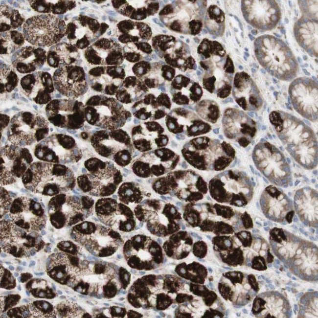 TTMP Antibody in Immunohistochemistry (Paraffin) (IHC (P))